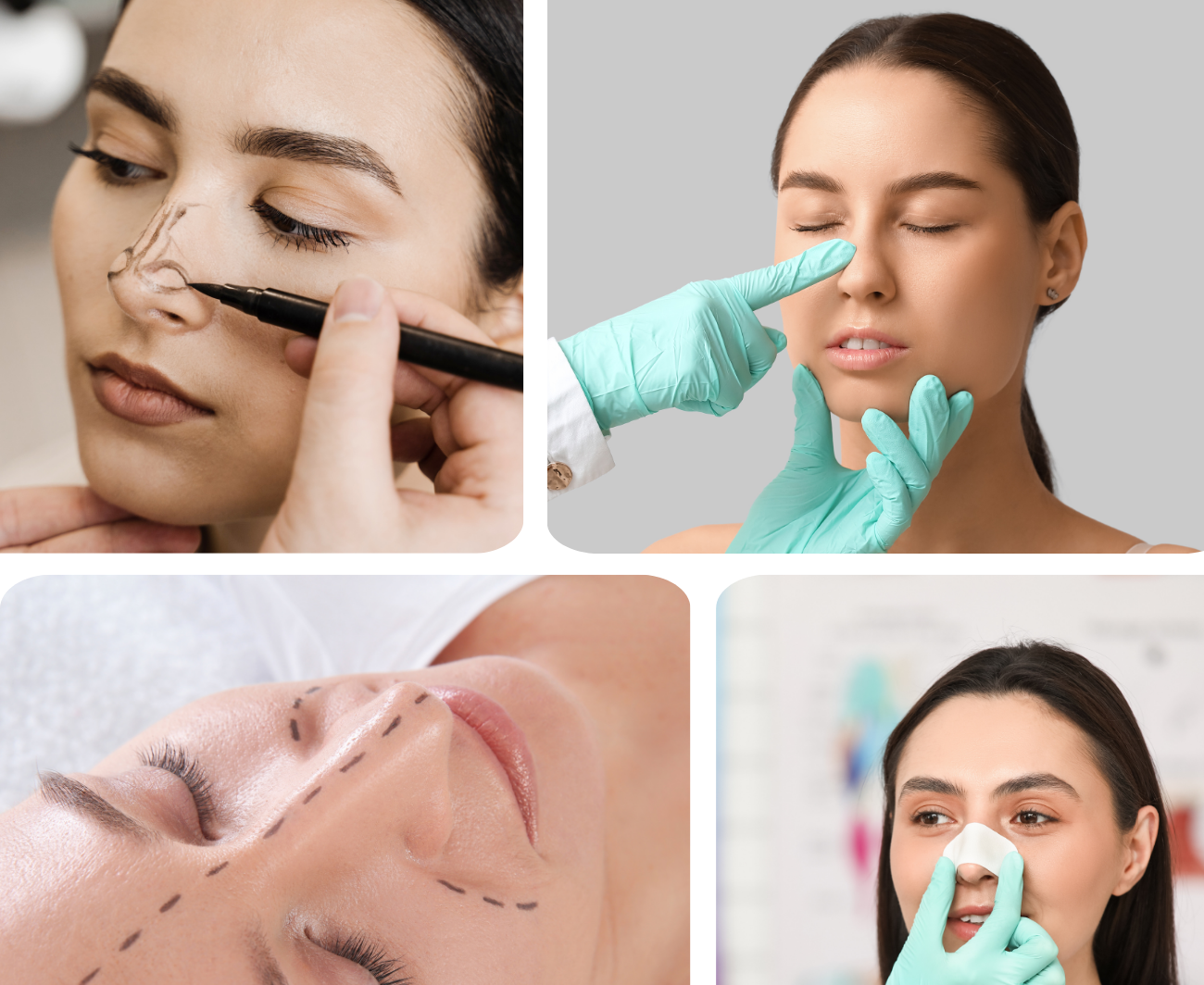Rhinoplastie-Dr chabbak hakim