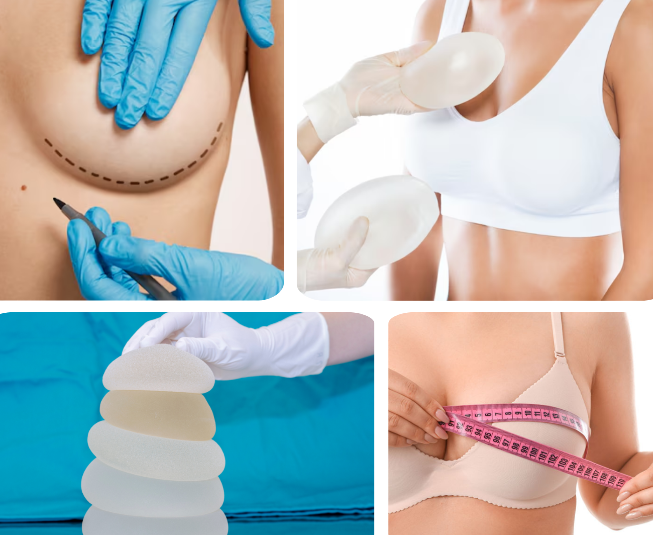 Chirurgie mammaire-Dr chabbak hakim