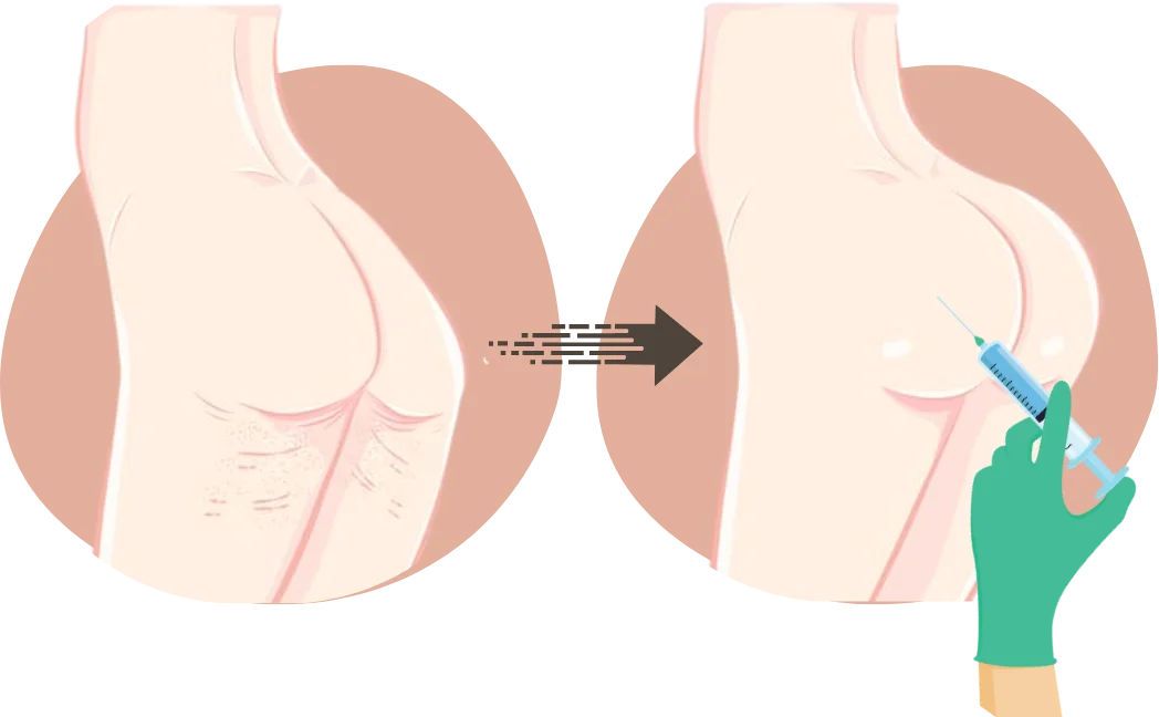 bbl-dr chabbak hakim (2)