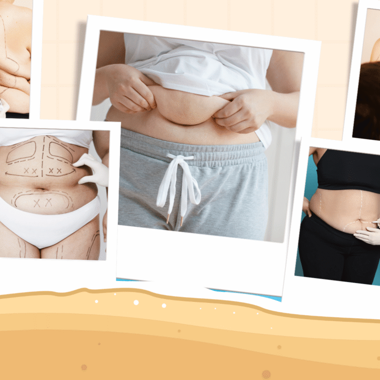 Liposuccion en été à Casablanca – Dr Chabbak Hakim | HC Aesthetics