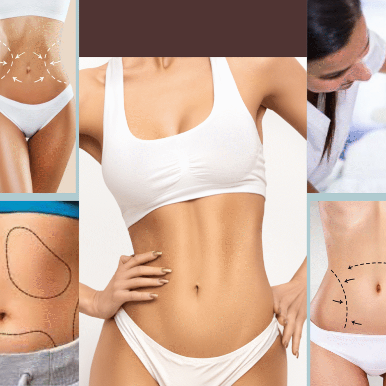 Abdominoplastie ou liposuccion : quelle intervention est faite pour vous ?