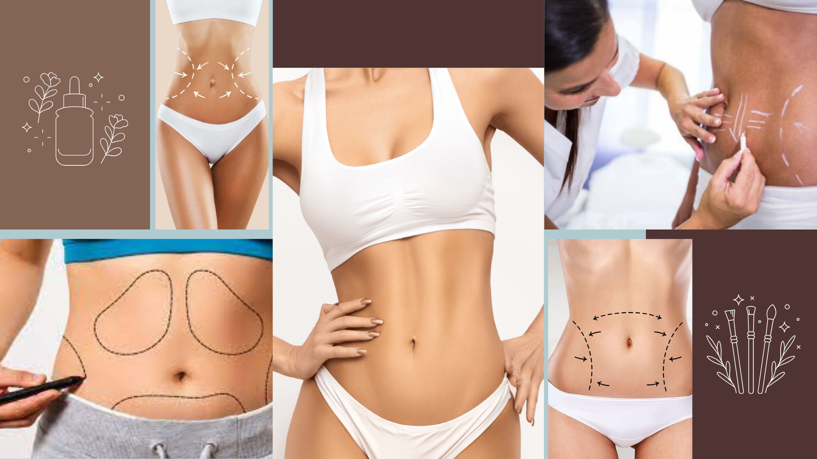 Abdominoplastie ou liposuccion : quelle intervention est faite pour vous ?