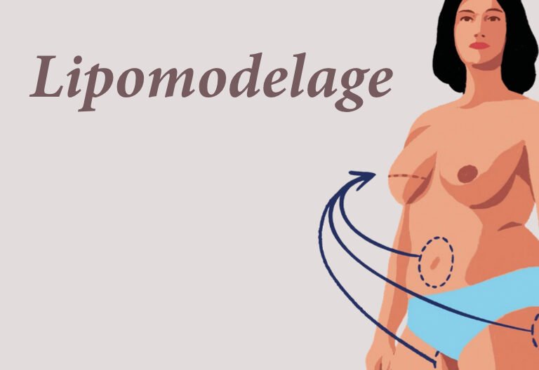 lipofilling mammaire