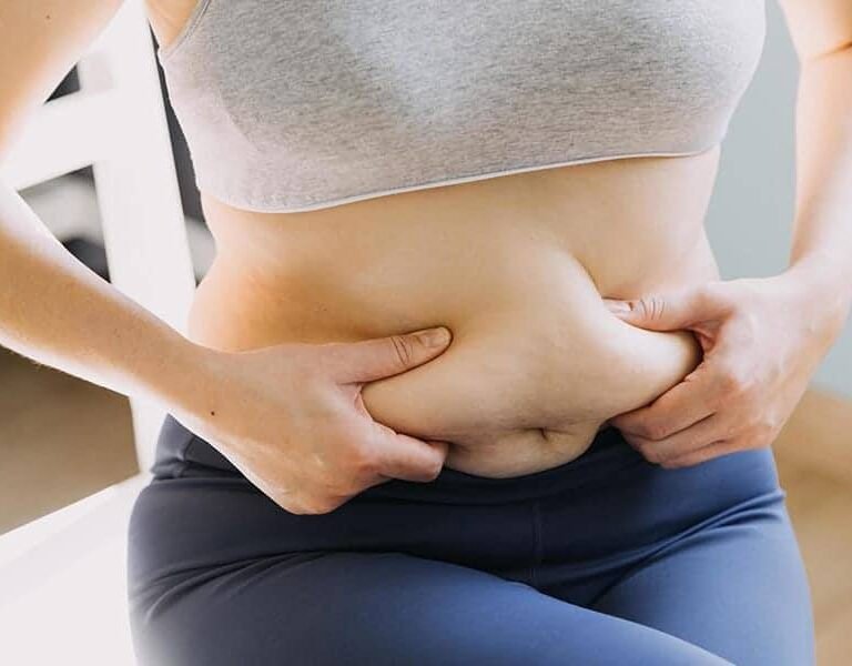 Abdominoplastie après grossesse : retrouver son ventre et sa confiance