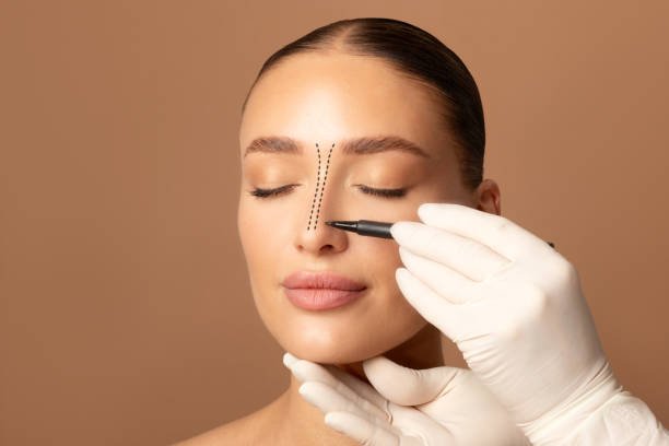 Pourquoi choisir la rhinoplastie ultrasonique à Casablanca pour un nez harmonieux et précis ?