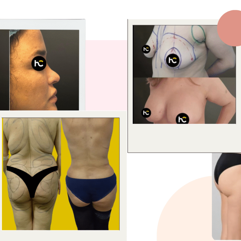 meilleur chirurgien esthétique à Casablanca (2)