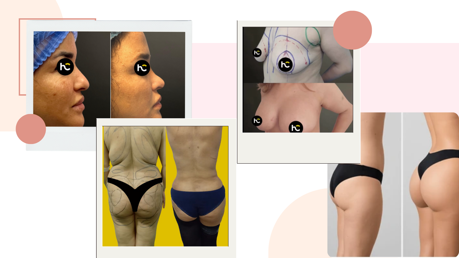 meilleur chirurgien esthétique à Casablanca (2)