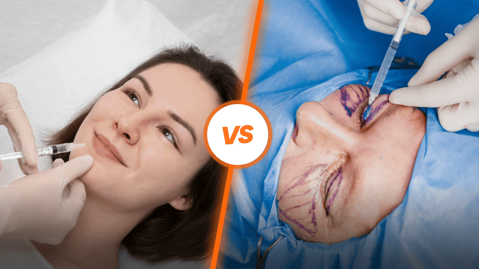 Acide hyaluronique ou chirurgie esthétique